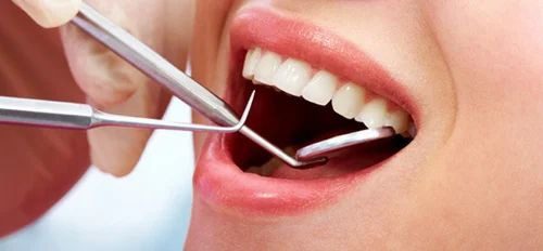 جراحی زیبایی لثه چیست
