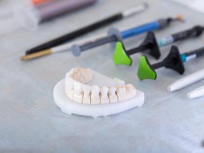 هزینه پروتز های دندان  