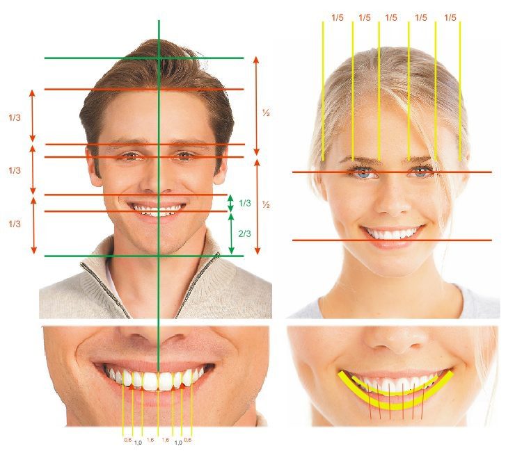 اصلاح فاصله افقی و عمودی دندان
