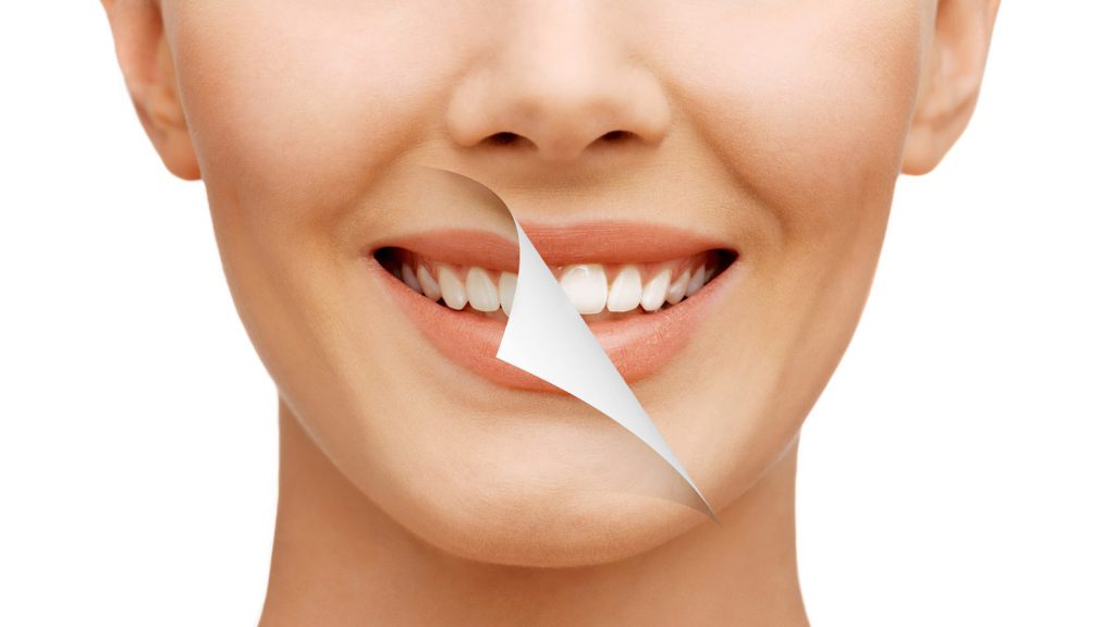 اصلاح طرح لبخند فوری چیست؟