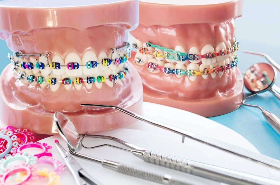 تأثیر سن انجام ارتودنسی بر طول عمر دندان